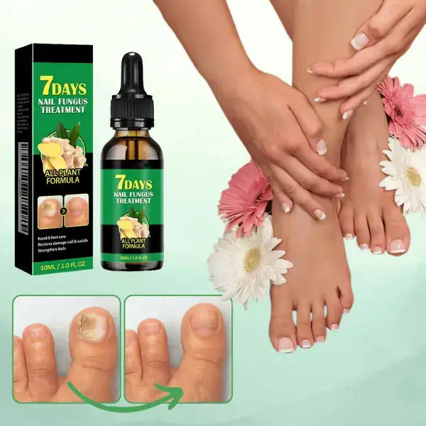 TRATAMIENTO ANTI HONGOS 7 DÍAS 100% NATURAL