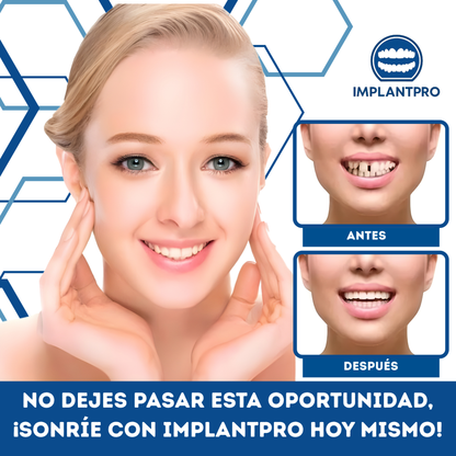 IMPLANTPRO | SONRISA NATURAL Y ESTÉTICA PARA UNA CONFIANZA RENOVADA