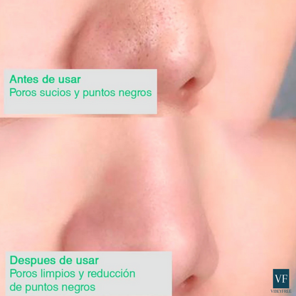 Green Mask™ Mascarilla de Limpieza Profunda de té Verde - [PROMOCIÓN DISPONIBLE SOLO HOY]