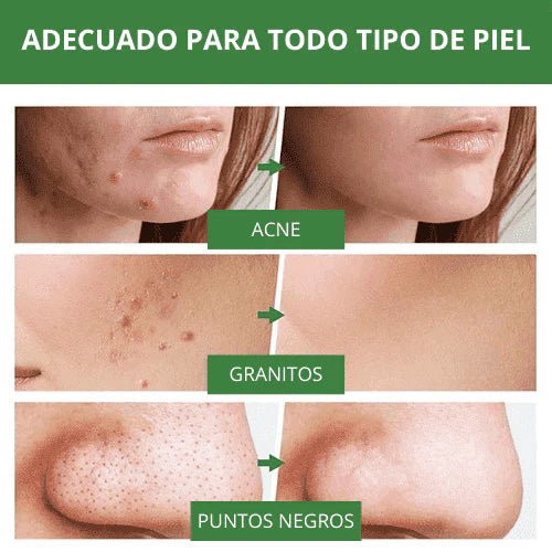 Green Mask™ Mascarilla de Limpieza Profunda de té Verde - [PROMOCIÓN DISPONIBLE SOLO HOY]