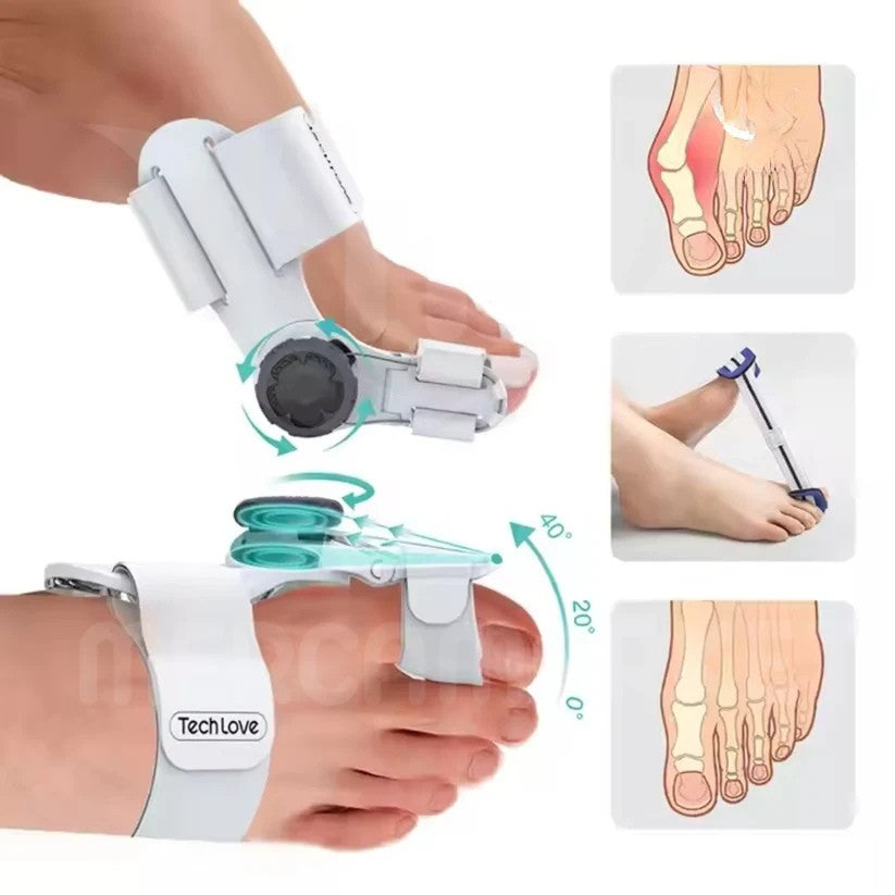 Corrector de Juanetes Ajustable - Alivia el Dolor y Alinea