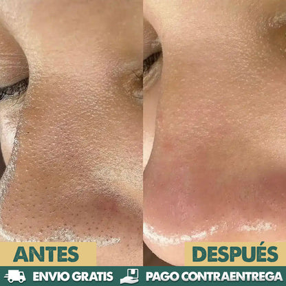 Dr. Melaxin Peel Shot | Ampolla Exfoliante Iluminadora